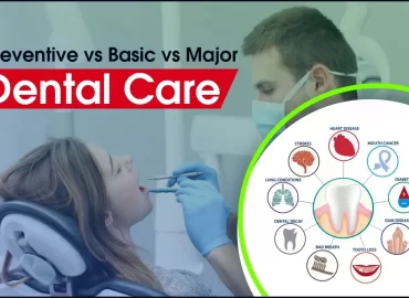 Preventive Dental Care vs Basic Dental Care vs Major Dental Care: What’s the Difference?
